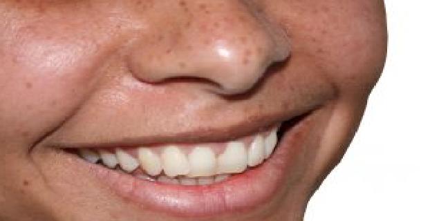 Ortodoncja